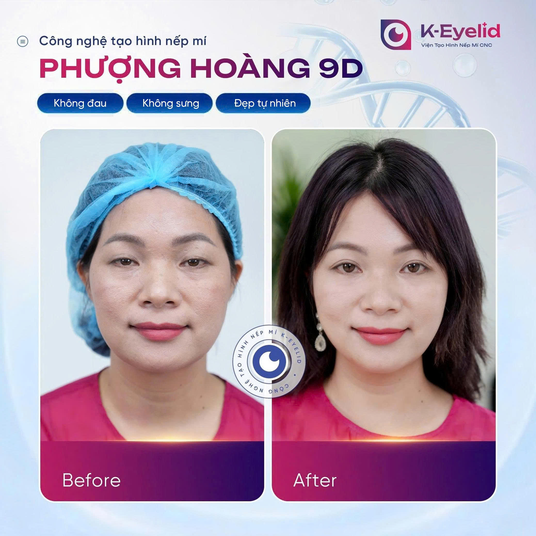 Trang chủ 22 z6721333236992 016571285af5e862513b0b30106d5315